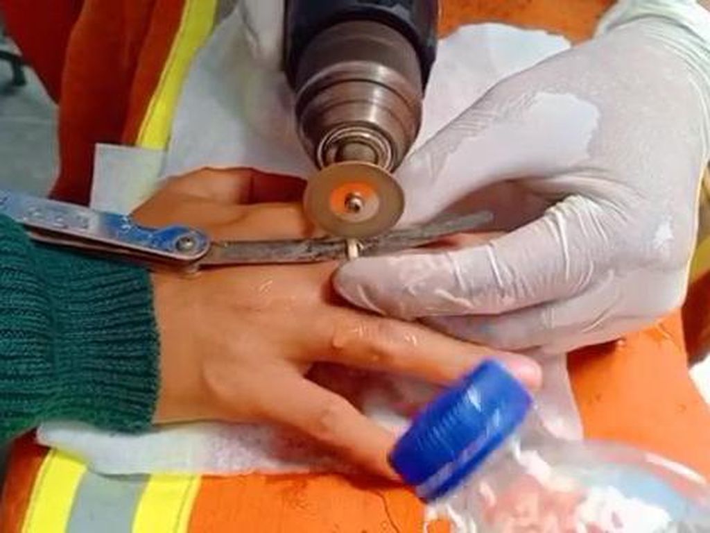 Damkar Surabaya Potong Cincin Kawin Warga yang Jarinya Bengkak Gegara Hamil Damkar Surabaya Potong Cincin Kawin Warga yang Jarinya Bengkak Gegara Hamil