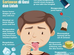 Cara Mudah Mengatasi Sariawan di Gusi dan Lidah