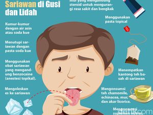 Cara Mudah Mengatasi Sariawan di Gusi dan Lidah Cara Mudah Mengatasi Sariawan di Gusi dan Lidah