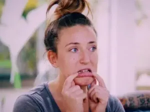 Filler Bibir Berakhir Bencana, Bibir Wanita Ini Ditumbuhi Banyak Bisul