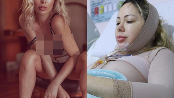 Penampilan Model Playboy yang Kecanduan Operasi Plastik, Habiskan Rp 4,2 M