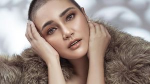 8 Pesona Feby Febiola Pemotretan Berkepala Plontos, Kini Jadi Cancer Survivor