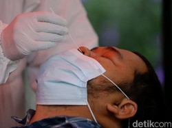 CT Value Tinggi Bukan Berarti Bebas dari COVID-19, Ini Alasannya