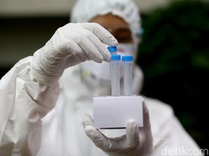 Menkes Jelaskan Alasan Positivity Rate Cetak Rekor Usai Liburan Menkes Jelaskan Alasan Positivity Rate Cetak Rekor Usai Liburan