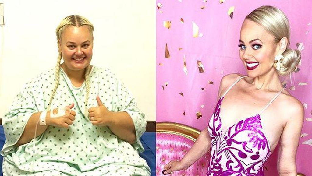 8 Potret Perubahan Drastis Wanita Turun BB 90 Kg, Terinspirasi Boneka Barbie