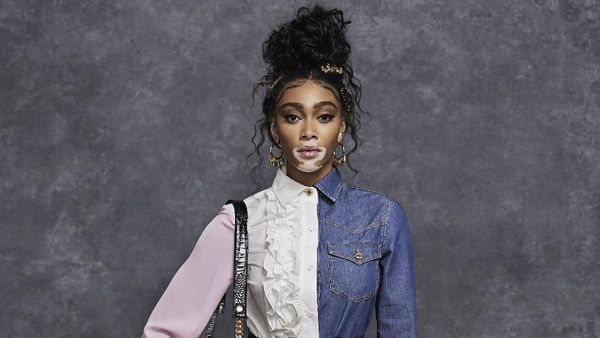 10 Gaya Winnie Harlow Jadi Bintang Koleksi Busana Pre Fall 2021 Moschino