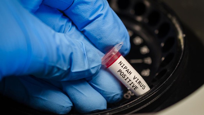 Scientist analyzing nipah virus positive blood sample