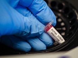Geger Virus Nipah di India, Angka Kematiannya Disebut Lebih Tinggi dari COVID