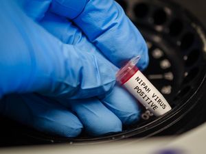 Sempat Bikin Geger, WHO Ungkap Fakta Baru Virus Nipah yang Merebak di India Sempat Bikin Geger, WHO Ungkap Fakta Baru Virus Nipah yang Merebak di India