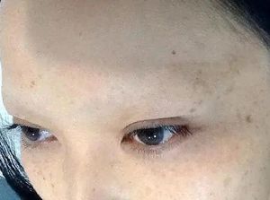 Lakukan Prosedur Kecantikan Demi Punya Alis Goals, Akhirnya Malah Jadi Botak