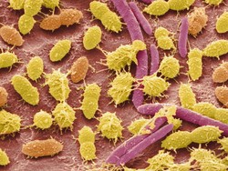 Lisosom: Fungsi dan Penyakit Gangguan Penyimpanannya