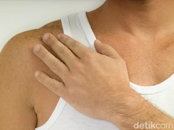 Minimalisir Kecacatan, P2PML Kemenkes Kampanyekan Eliminasi Kusta