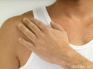 Minimalisir Kecacatan, P2PML Kemenkes Kampanyekan Eliminasi Kusta Minimalisir Kecacatan, P2PML Kemenkes Kampanyekan Eliminasi Kusta