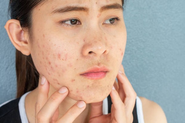 Perubahan kondisi kulit dapat membuat skincare tidak bekerja optimal / foto: istockphoto.com