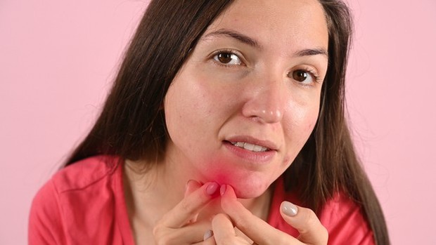 Redness/foto: freepik.com Redness