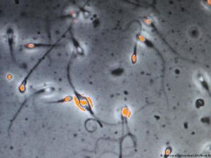 Hasil Studi: COVID-19 Bisa Turunkan Kesuburan pada Pria