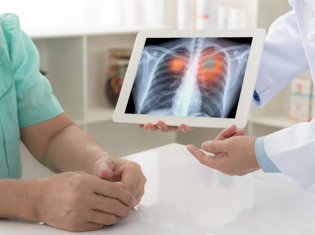 Viral Tes Kesehatan Paru dengan Tahan Napas, Ini Penjelasan Dokter Viral Tes Kesehatan Paru dengan Tahan Napas, Ini Penjelasan Dokter