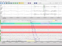 Suara Dentuman dan Jejak Tanah Bergerak di Sukabumi