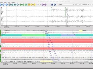 Suara Dentuman dan Jejak Tanah Bergerak di Sukabumi Suara Dentuman dan Jejak Tanah Bergerak di Sukabumi