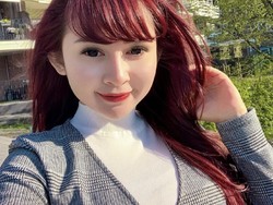 Dituding Operasi Payudara dan Hidung, Winny Putri Lubis: Aku Cantik dari Lahir!