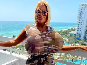 Perubahan Drastis Model yang Lakukan Pembesaran Payudara Hingga 137 Cm