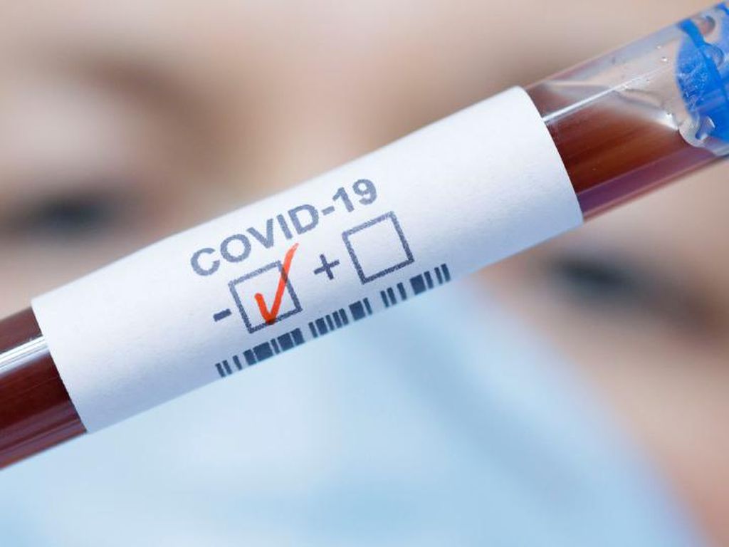 Viral Obat Cina COVID-19 Lianhua Qingwen Dilarang Beredar, Ini Penegasan BPOM Viral Obat Cina COVID-19 Lianhua Qingwen Dilarang Beredar, Ini Penegasan BPOM