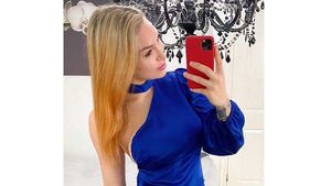 8 Potret Wanita Habiskan Rp 1,3 M untuk Oplas, Bikin Ibu-ibu Insecure