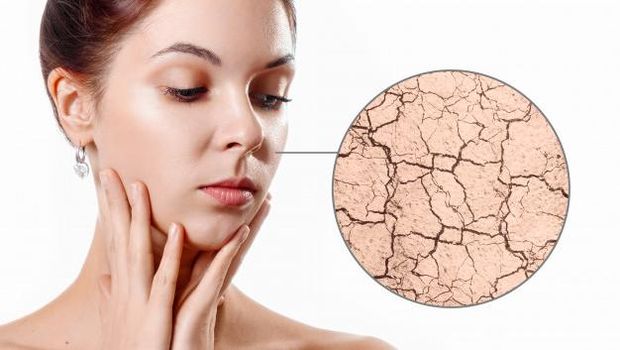 Cover Dry Skin Foto:google/freepik