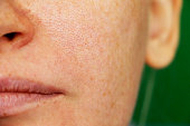 kulit kotor karena sisa minyak dan face washFoto:google/freeimages