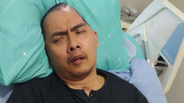 Mantan Kasat Reskrim Polres Wonogiri, Kompol Aditia Mulya jadi korban pengeroyokan saat melerai perkelahian 2 kelompok silat Mantan Kasat Reskrim Polres Wonogiri, Kompol Aditia Mulya jadi korban pengeroyokan saat melerai perkelahian 2 kelompok silat