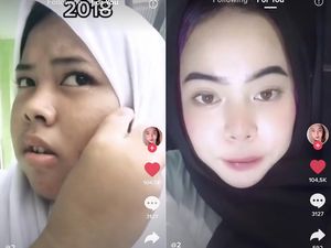Viral Remaja Glow Up Dalam 2 Tahun, Wajah Jerawat Jadi Mulus Bikin Penasaran