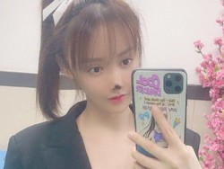 Hidung Artis China Gao Liu Membusuk Sampai Menghitam karena Oplas Gagal