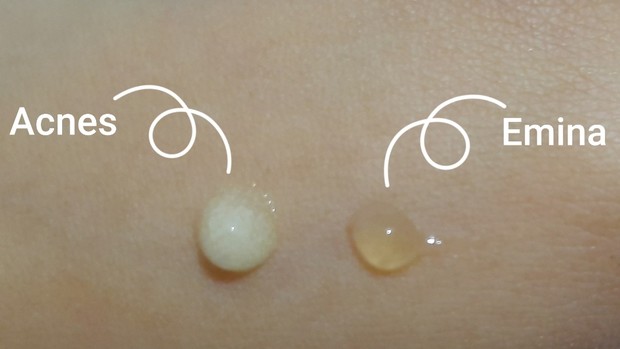 Tekstur acne gel Acnes dan Emina/beautynesia