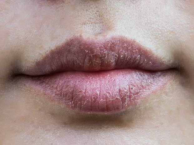 Cara alami mencerahkan warna gelap di bibir (pinterest.com/wunderweib.de)