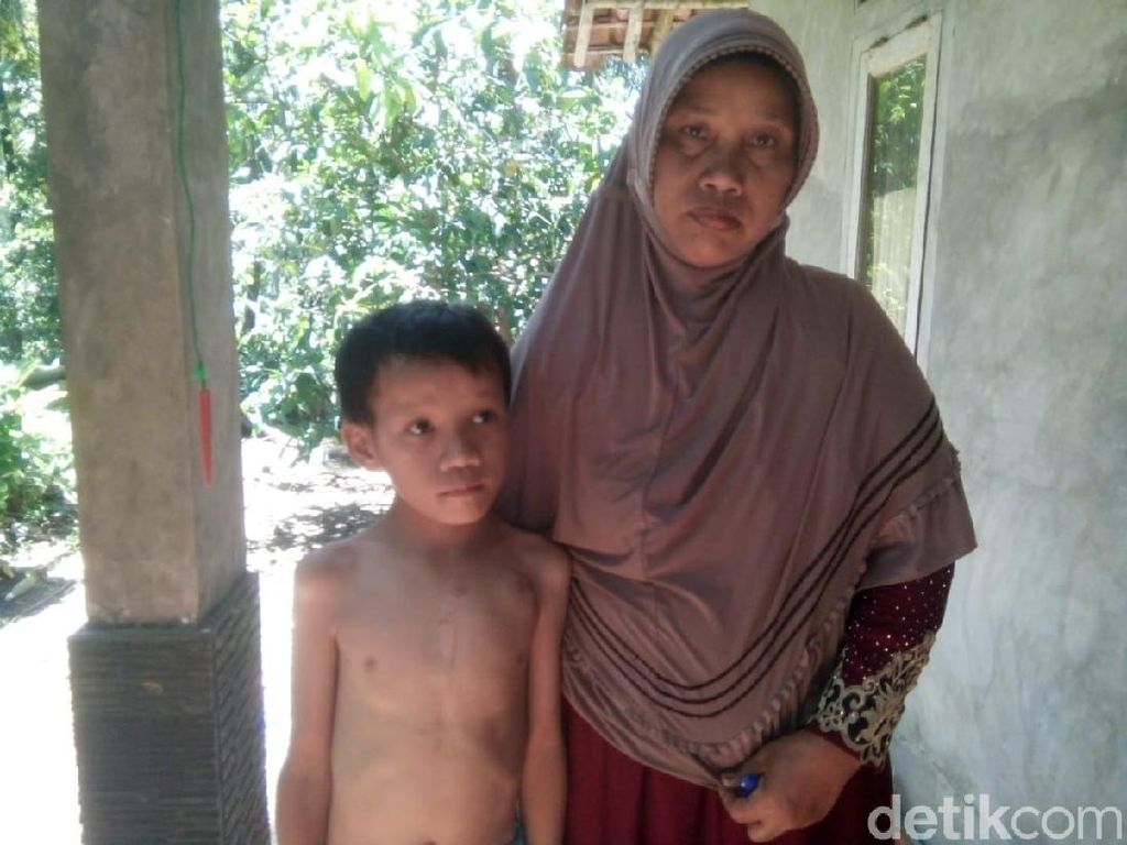 Kisah Bocah Pangandaran Bertahan dengan Kondisi Jantung Bocor Kisah Bocah Pangandaran Bertahan dengan Kondisi Jantung Bocor