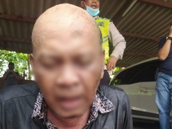 Ketakutan Sendiri, Pria di Surabaya Siram Bensin dan Bakar Pengendara Motor