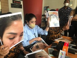 Hadir di Sidang Cerai Nindy, Ibunda Ungkap Lebam di Tubuh Sang Anak