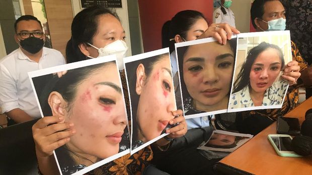 Nindy Ayunda Nindy Ayunda datangi Komnas Perempuan, tunjukan bukti KDRT