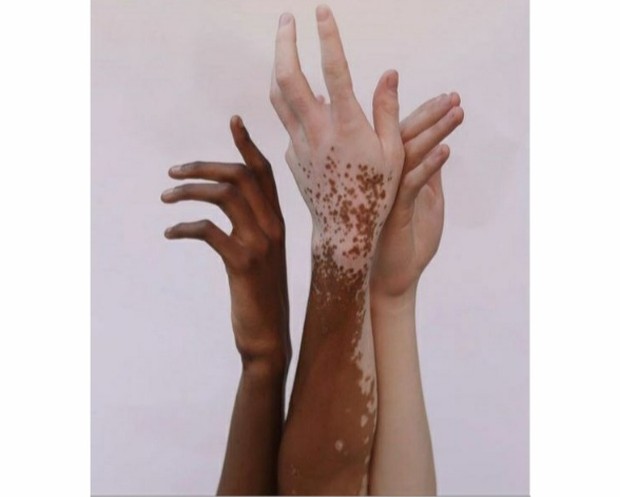 Fakta kulit orang Asia