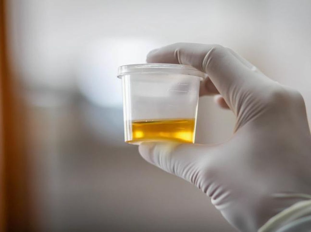 Duh! Wanita Ini Nekat Minum Urine karena Percaya Bisa Sembuhkan Covid-19 Duh! Wanita Ini Nekat Minum Urine karena Percaya Bisa Sembuhkan Covid-19