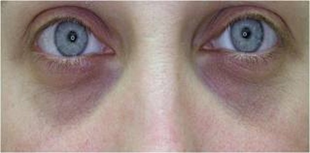 Blueish Circles