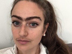 Curhat Wanita Punya Kumis & Alis Nyambung Mirip Pria, Sering Diteriaki Orang