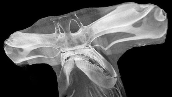 Deretan Foto X-Ray yang Mungkin Belum Pernah Kamu Lihat