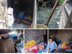 Viral Anak Lumpuh di Surabaya Tinggal di Gubuk Tak Layak Huni