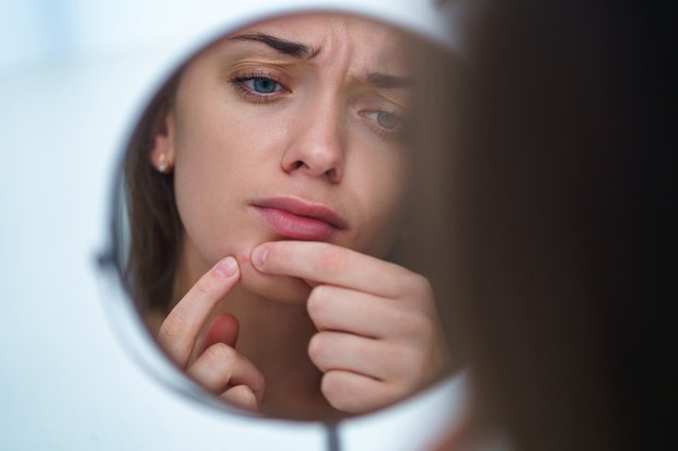 jerawat merupakan salah satu tanda bahwa skin barrier mu sudah rusak.