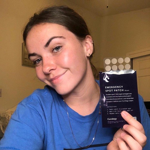 n Hydrocolloid Band-Aid Digunakan untuk Atasi Jerawat