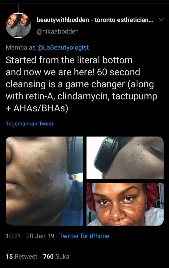 Hanya dengan 60 Second Rule. Dapatkan Kulit Mulus, Glowing Sempurna/twitter.com/LaBeautylogist