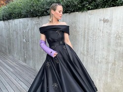 Tangan Cedera, Artis Ini Jadi Viral Pakai Gips Mewah dari Prada