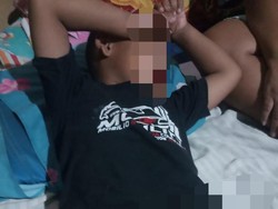 Bocah di Bojonegoro Tiba-tiba Seperti Dikhitan, Warga Sebut Disunat Jin