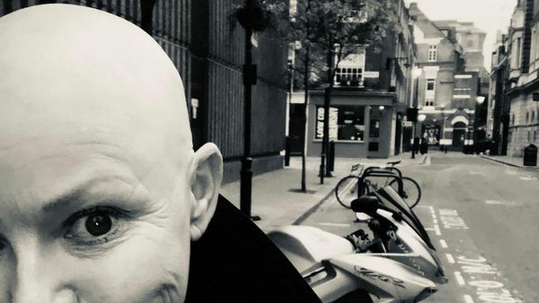 7 Potret Presenter yang Kariernya Hancur karena Botak, Sempat Jadi Gelandangan